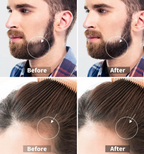 Derma Roller - Titanium 0.5mm